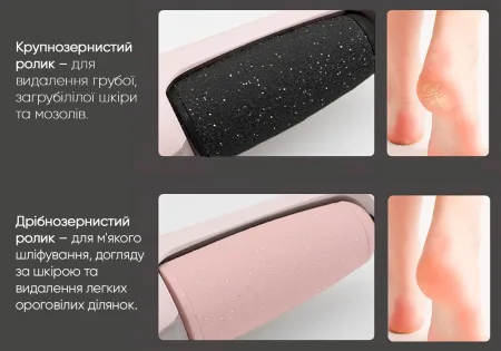 Електрична пемза для ніг EasyFit (апарат для педикюру)