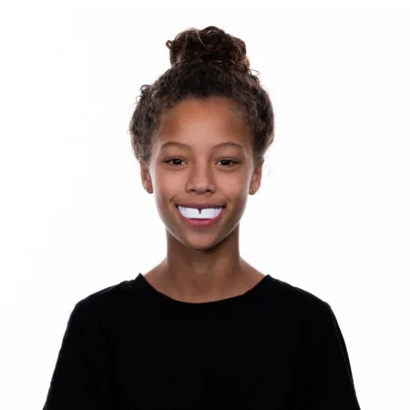 Капа OPRO Snap-Fit White (art.002139010)